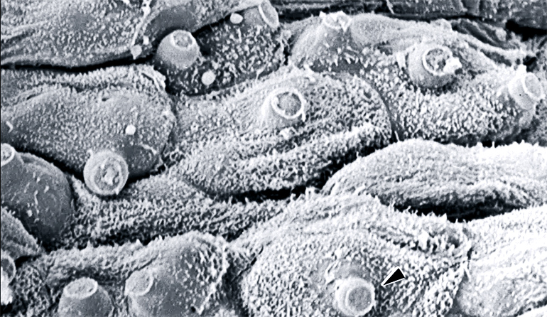 Grayscale tile-like skin cells with round tubes sticking up from each one.